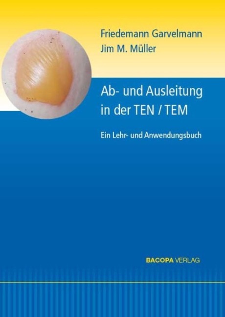 Ab- und Ausleitungsverfahren in der TEN/TEM. - Friedemann Garvelmann, Jim M. Müller