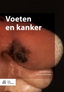 Cover-Bild zum Titel 'Voeten en kanker' von 'Anton C. De Groot, Johan Toonstra'