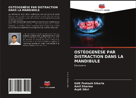 OSTÉOGENÈSE PAR DISTRACTION DANS LA MANDIBULE - Udit Prakash Sikaria, Amil Sharma, Arpit Sikri