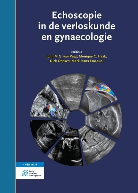 Echoscopie in de Verloskunde En Gynaecologie - 
