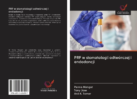 PRF w stomatologii odtwórczej i endodoncji - Panna Mangat, Tony Jose, Anil K. Tomer