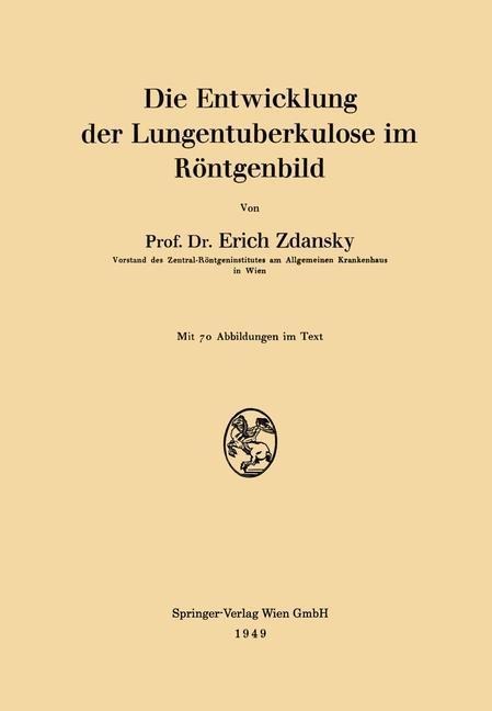 Die Entwicklung der Lungentuberkulose im Röntgenbild - Erich Zdansky