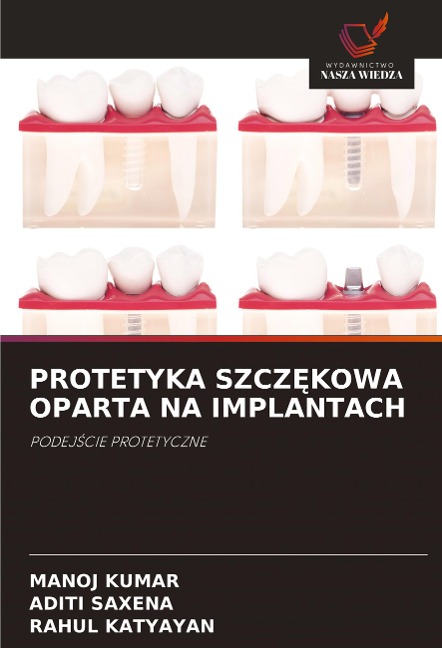 PROTETYKA SZCZ¿KOWA OPARTA NA IMPLANTACH - Manoj Kumar, Aditi Saxena, Rahul Katyayan