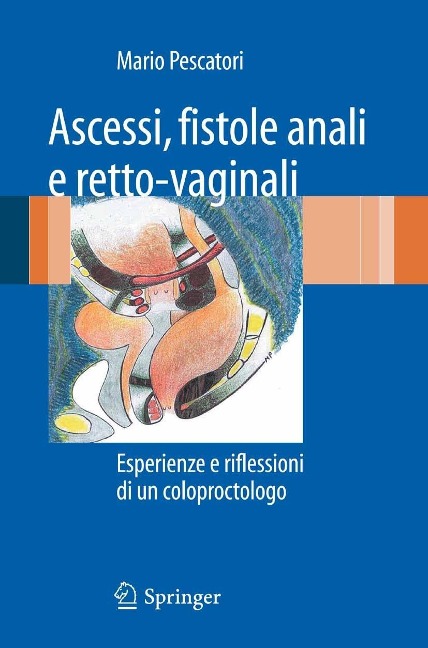 Ascessi, fistole anali e retto-vaginali - Mario Pescatori