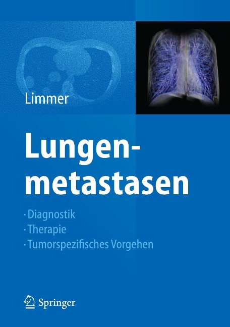 Lungenmetastasen - 
