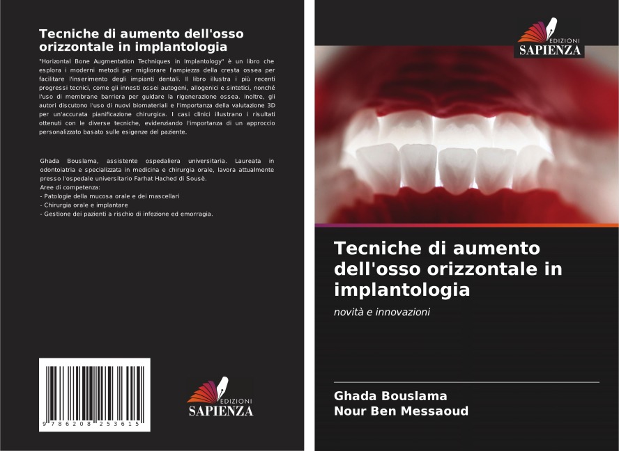 Tecniche di aumento dell'osso orizzontale in implantologia - Ghada Bouslama, Nour Ben Messaoud