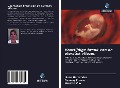 Cover-Bild zum Titel 'Voortijdige breuk van de eierstok vliezen' von 'Iliana Hernández, Osmany Franco, Lizzette Vila'