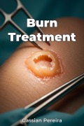 Cover-Bild zum Titel 'Burn Treatment' von 'Cassian Pereira'