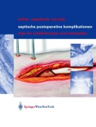 Cover-Bild zum Titel 'Septische postoperative Komplikationen' von 'Matthias Bühler, Hergo G. K. Schmidt, Martin Engelhardt'