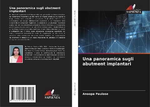 Una panoramica sugli abutment implantari - Anoopa Paulose