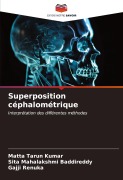 Cover-Bild zum Titel 'Superposition céphalométrique' von 'Matta Tarun Kumar, Sita Mahalakshmi Baddireddy, Gajji Renuka'