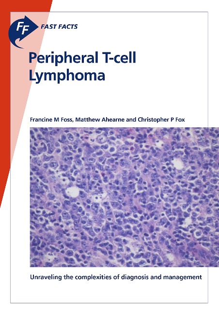 Fast Facts: Peripheral T-cell Lymphoma - F. Foss, M. Ahearne, C. P. Fox