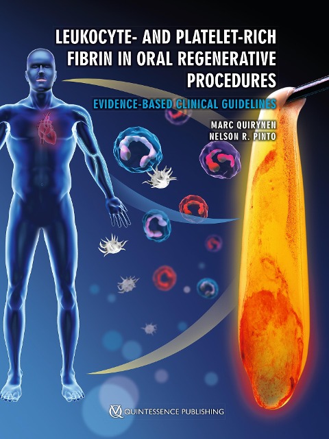 Leukocyte- and Platelet-Rich Fibrin in Oral Regenerative Procedures - Marc Quirynen, Nelson R. Pinto