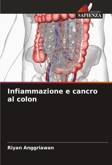 Infiammazione e cancro al colon - Riyan Anggriawan
