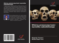 Cover-Bild zum Titel 'Wtórny przeszczep ko¿ci wyrostka z¿bodo¿owego' von 'Nagaraju Tanneru, Nanda Gopal Vura'