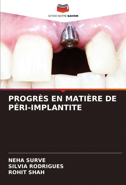 PROGRÈS EN MATIÈRE DE PÉRI-IMPLANTITE - Neha Surve, Silvia Rodrigues, Rohit Shah