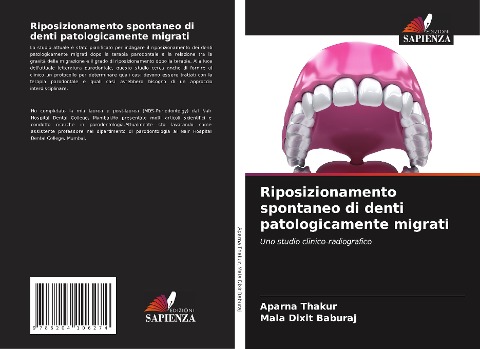Riposizionamento spontaneo di denti patologicamente migrati - Aparna Thakur, Mala Dixit Baburaj