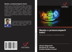 Cover-Bild zum Titel 'Nauka o przeszczepach ko¿ci' von 'Akash Rajpurohit, Ravikiran N. Gowda, Kratika Baldua Porwal'