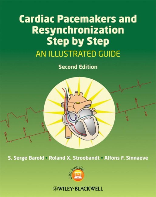 Cardiac Pacemakers and Resynchronization Therapy Step-by-Step - S. Serge Barold, Roland X. Stroobandt, Alfons F. Sinnaeve