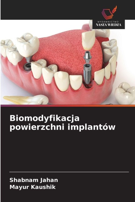 Biomodyfikacja powierzchni implantów - Shabnam Jahan, Mayur Kaushik