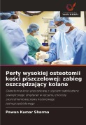 Cover-Bild zum Titel 'Per¿y wysokiej osteotomii ko¿ci piszczelowej: zabieg oszcz¿dzaj¿cy kolano' von 'Pawan Kumar Sharma'