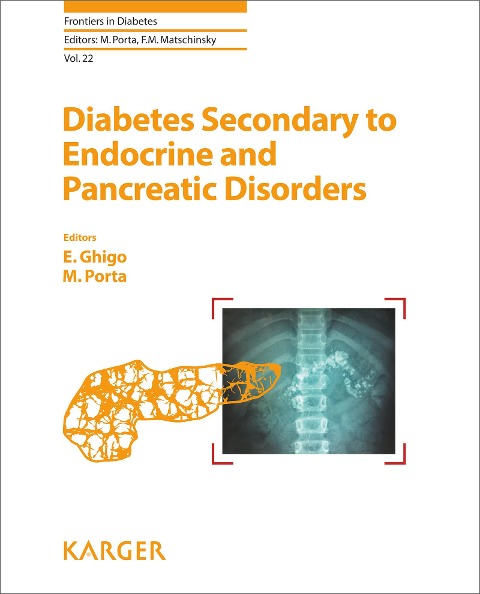 Diabetes Secondary to Endocrine and Pancreatic Disorders - 
