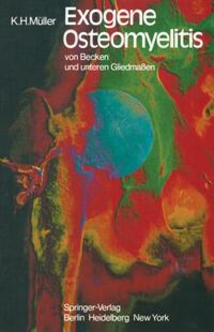 Exogene Osteomyelitis von Becken und unteren Gliedmaßen - K. H. Müller