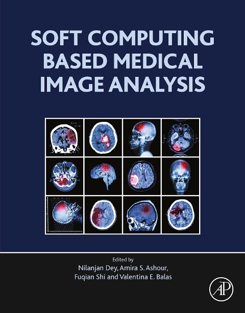 Soft Computing Based Medical Image Analysis - Nilanjan Dey, Amira S. Ashour, Fuquian Shi, Valentina Emilia Balas