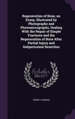 Regeneration of Bone, an Essay, Illustrated by Photographs and Photomicrographs, Dealing With the Repair of Simple Fractures and the Regeneration of Bone After Partial Injury and Subperiosteal Resection - Henry S Wieder