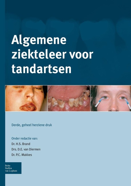 Algemene Ziekteleer Voor Tandartsen - 