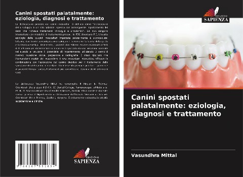 Canini spostati palatalmente: eziologia, diagnosi e trattamento - Vasundhra Mittal