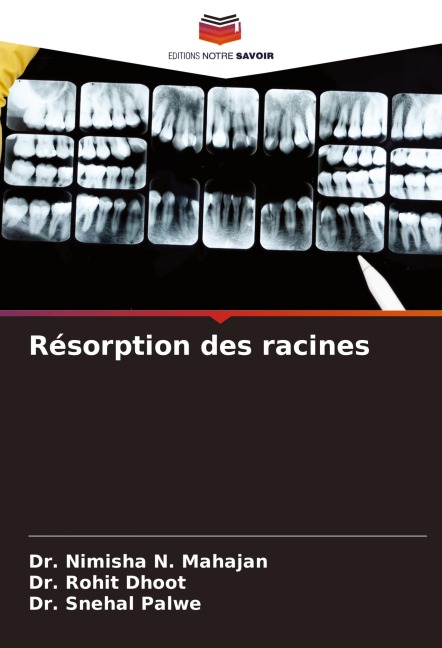 Résorption des racines - Nimisha N. Mahajan, Rohit Dhoot, Snehal Palwe