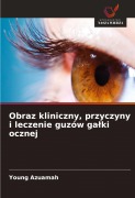 Cover-Bild zum Titel 'Obraz kliniczny, przyczyny i leczenie guzów ga¿ki ocznej' von 'Young Azuamah'