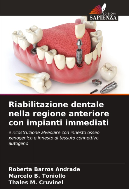 Riabilitazione dentale nella regione anteriore con impianti immediati - Roberta Barros Andrade, Marcelo B. Toniollo, Thales M. Cruvinel