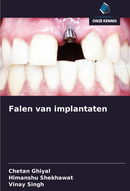 Falen van implantaten - Chetan Ghiyal, Himanshu Shekhawat, Vinay Singh