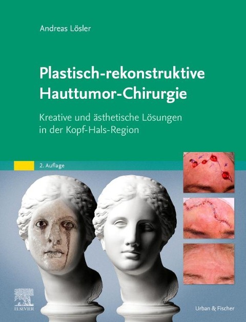 Plastisch-rekonstruktive Hauttumor-Chirurgie - Andreas Lösler