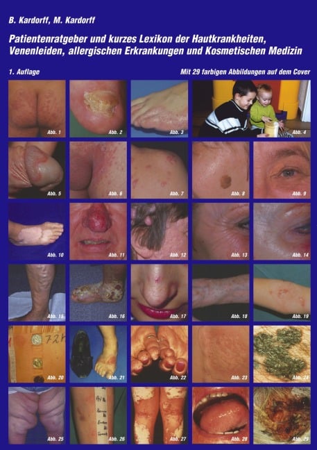 Patientenratgeber und kurzes Lexikon der Hautkrankheiten, Venenleiden, allergischen Erkrankungen und kosmetischen Medizin - Bernd Kardorff, Maria Kardorff