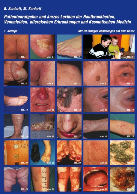 Patientenratgeber und kurzes Lexikon der Hautkrankheiten, Venenleiden, allergischen Erkrankungen und kosmetischen Medizin - Bernd Kardorff, Maria Kardorff