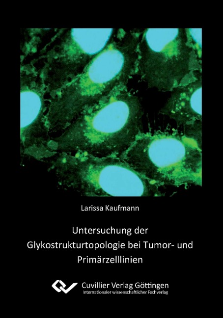 Untersuchung der Glykostrukturtopologie bei Tumor- und Primärzelllinien - Larissa Kaufmann