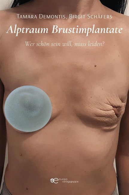 Alptraum Brustimplantate - Tamara Demontis, Birgit Schäfers