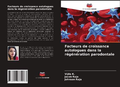 Facteurs de croissance autologues dans la régénération parodontale - Vijila K., Jacob Raja, Johnson Raja