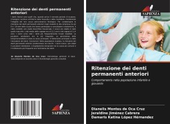 Cover-Bild zum Titel 'Ritenzione dei denti permanenti anteriori' von 'Dianelis Montes de Oca Cruz, Jeraldine Jiménez Cabrera, Damaris Katina López Hérnandez'