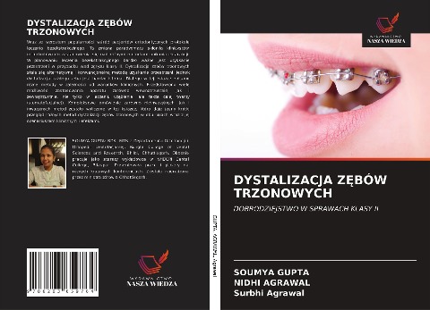 DYSTALIZACJA Z¿BÓW TRZONOWYCH - Soumya Gupta, Nidhi Agrawal, Surbhi Agrawal