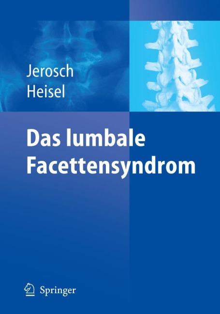 Das lumbale Facettensyndrom - Jörg Jerosch, Jürgen Heisel