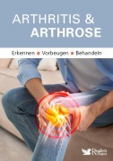 Cover-Bild zum Titel 'Arthritis & Arthrose' von ''