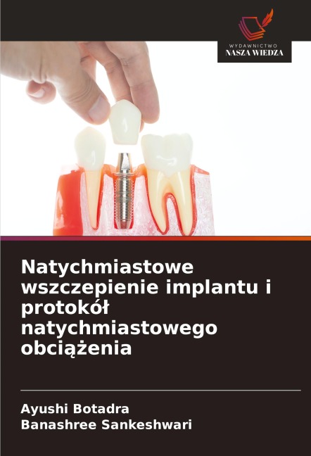 Natychmiastowe wszczepienie implantu i protokó¿ natychmiastowego obci¿¿enia - Ayushi Botadra, Banashree Sankeshwari