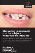Cover-Bild zum Titel 'Sterowana regeneracja ko¿ci w miejscu wszczepienia implantu' von 'Khyati Arora, Harikumar K, Rosamma Joseph'