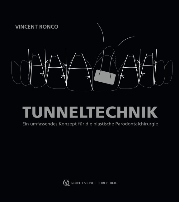 Tunneltechnik - Vincent Ronco