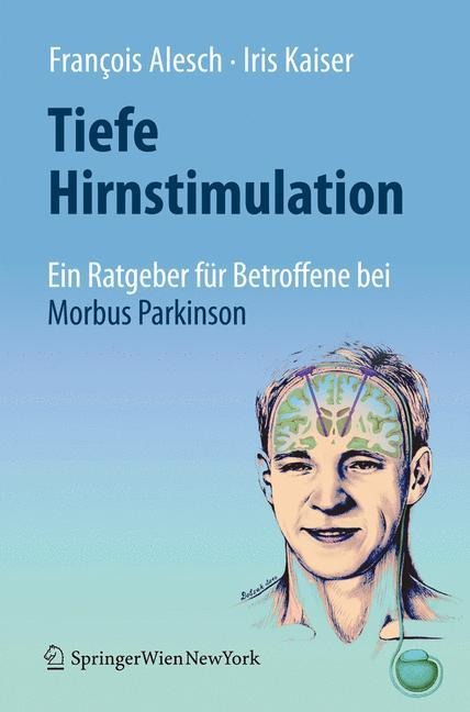 Tiefe Hirnstimulation: Ein Ratgeber für Betroffene bei Morbus Parkinson - Iris Kaiser, François Alesch