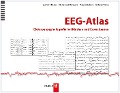 Cover-Bild zum Titel 'EEG-Atlas' von 'Warren T. Blume, Masako Kaibara, G. Bryan Young, Giannina M. Holloway'